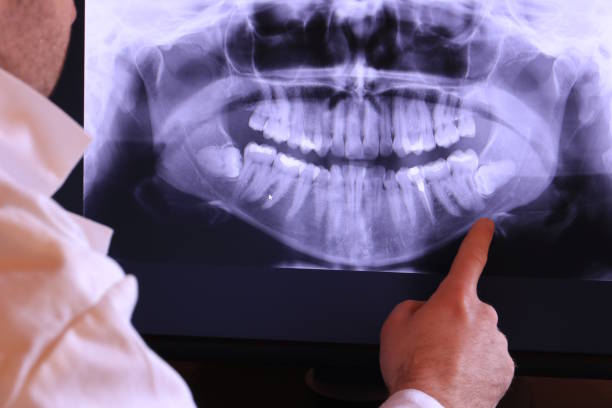 Best Emergency Root Canal Treatment in Shadeland, IN