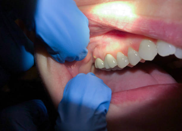 Best Emergency Orthodontic Repairs in Shadeland, IN