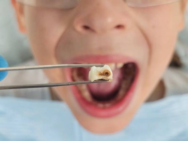 Best After-Hours Emergency Dentist in Shadeland, IN